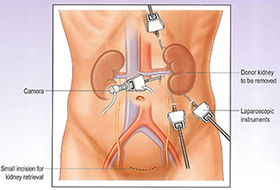 surgical procedure